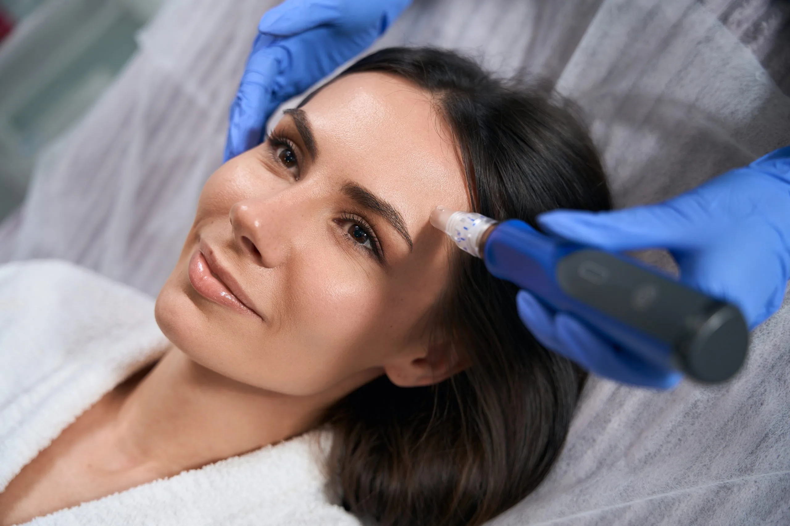 Clinician in blue gloves applying microneedling device to patient's cheek during treatment