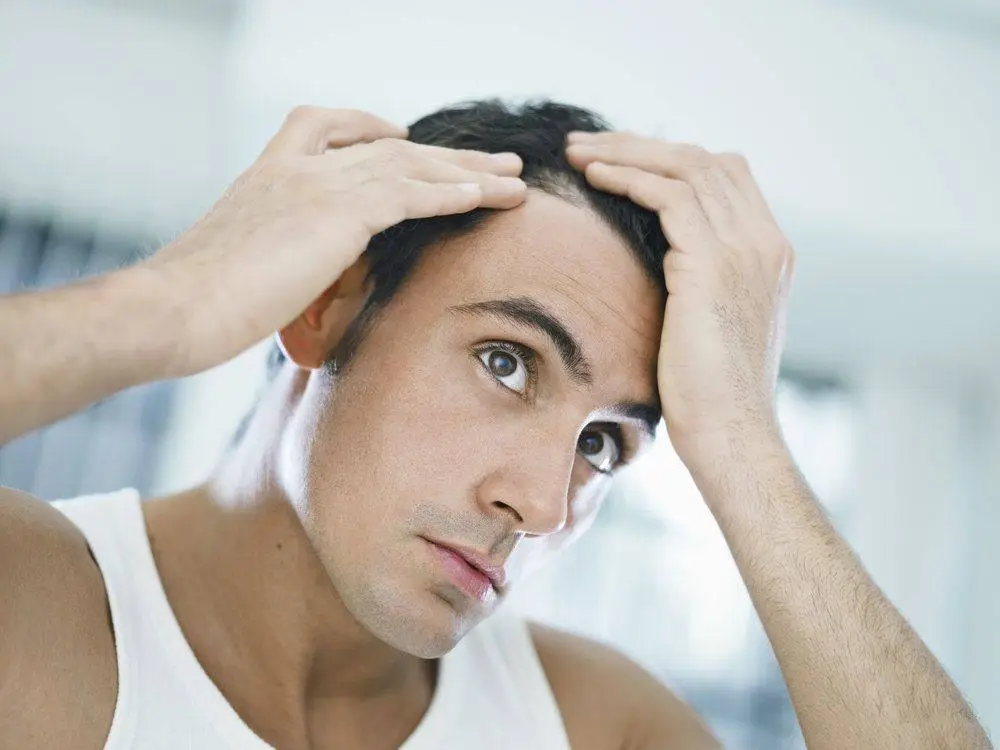 Hair Loss in Boston, MA
