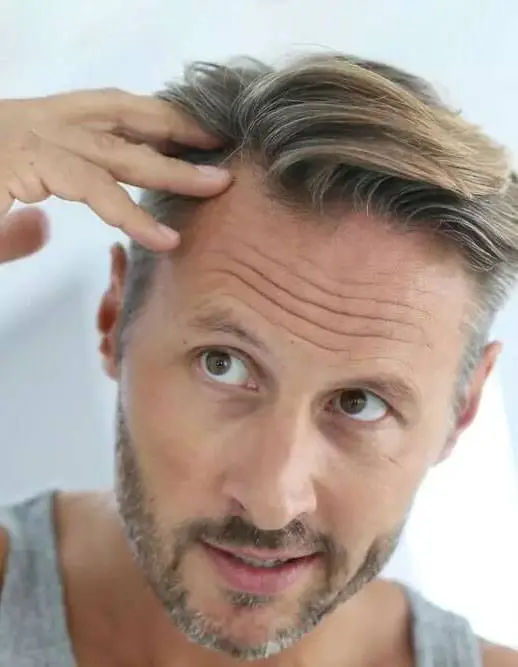 Scalp Micropigmentation in Boston Banner