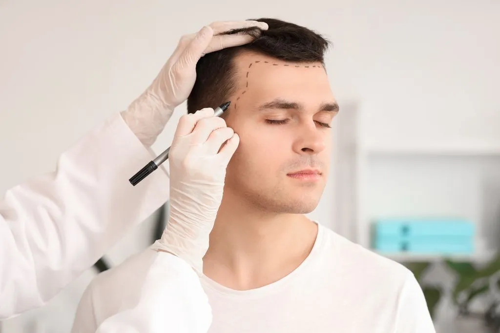 How Does Hair Transplant Work? Banner