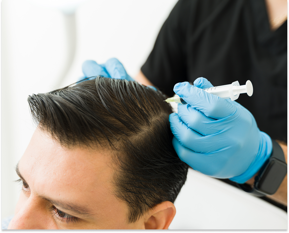 Clinician in blue gloves injecting hair restoration treatment into patient's scalp