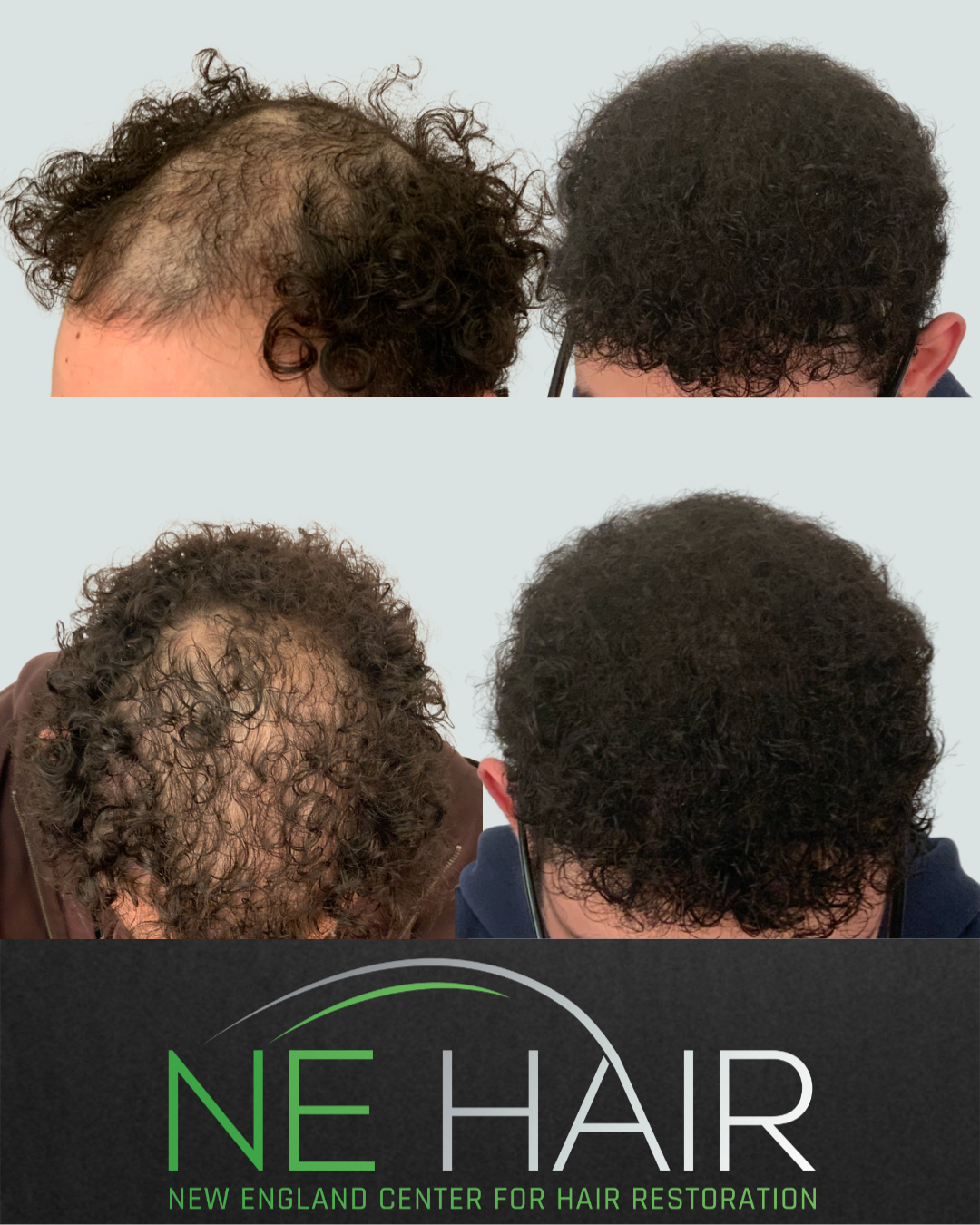 3.17 - 1 year - Cristian Palencia