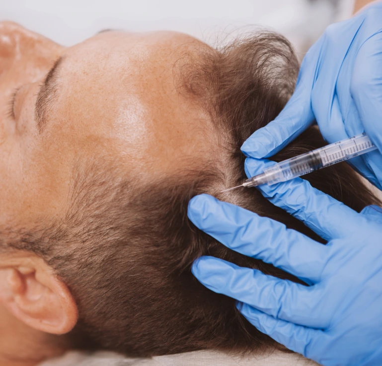 How Is Follicular Unit Transplant Performed? Banner