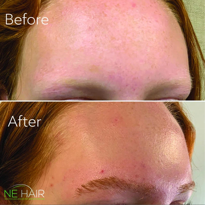 NEHAIR - gallery sectiom - image (1)