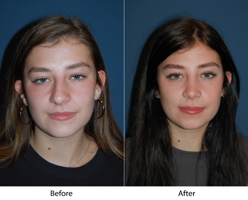 7259-3