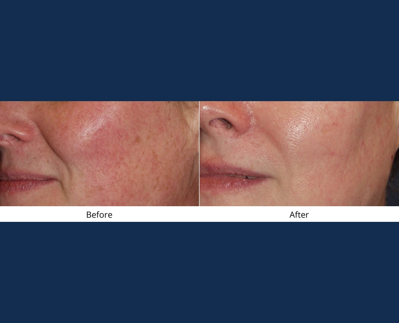 Only Faces Template - 2024-09-03T114529.065