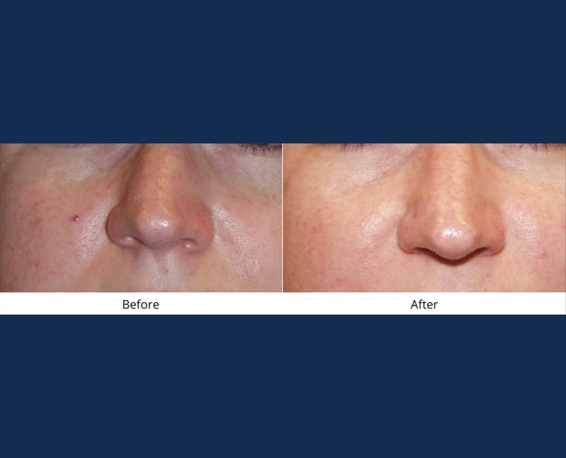 Only Faces Template - 2024-09-03T115117.035