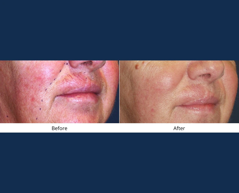 Only Faces Template - 2024-09-03T115655.108