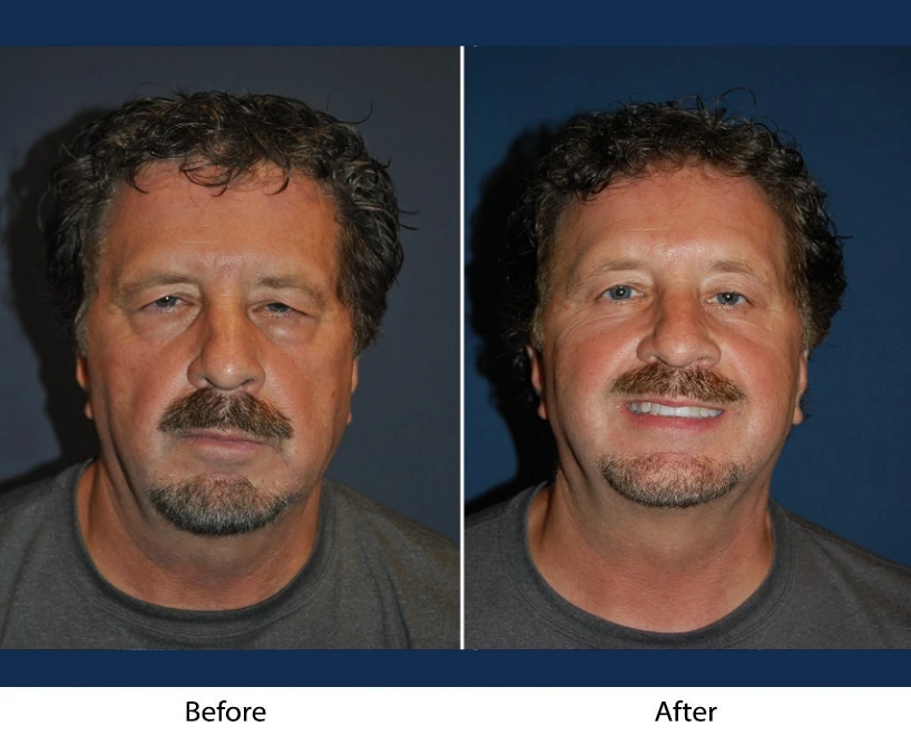 Only Faces Template - 2024-09-05T123656.892