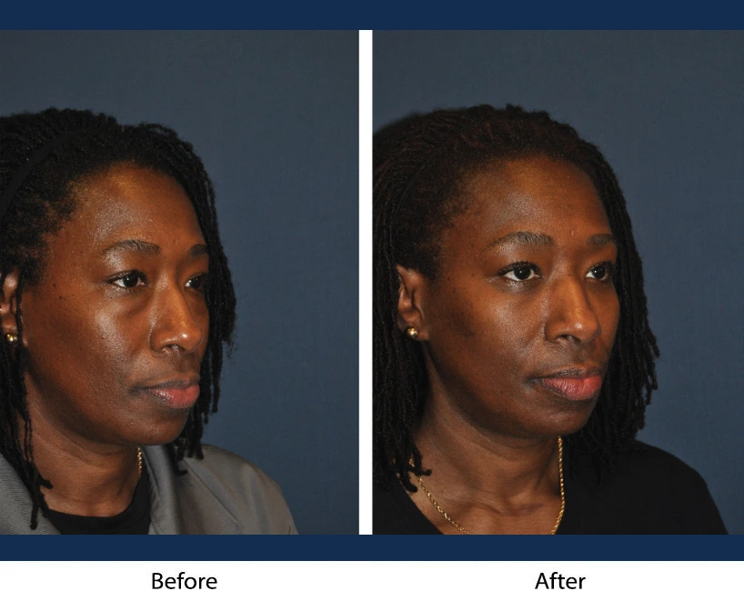 Only Faces Template - 2024-09-05T154437.880