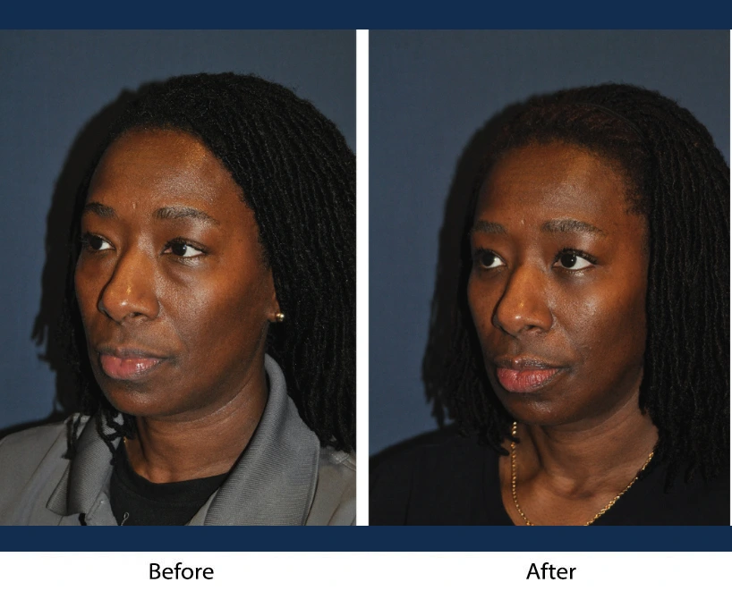 Only Faces Template - 2024-09-05T154559.107