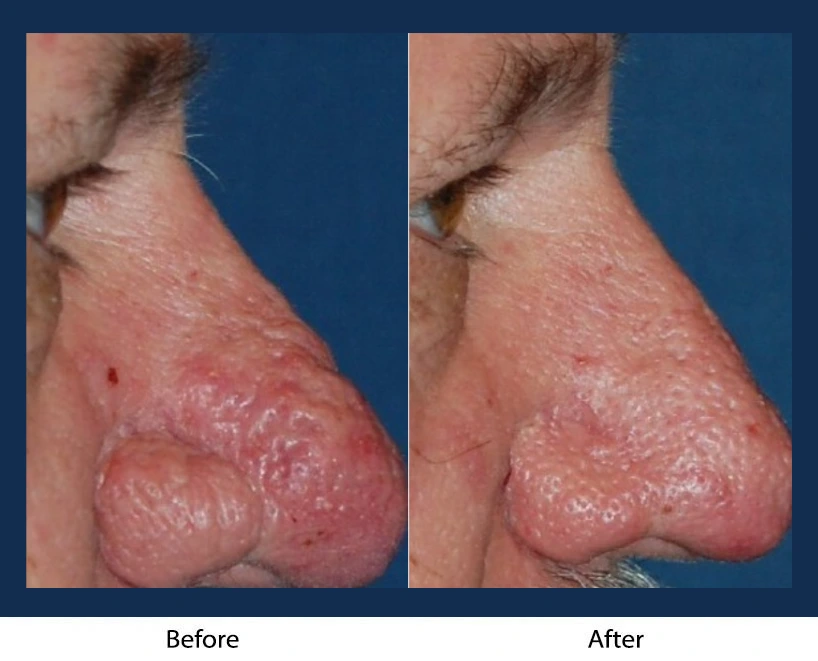 Only Faces Template - 2024-09-05T154923.108