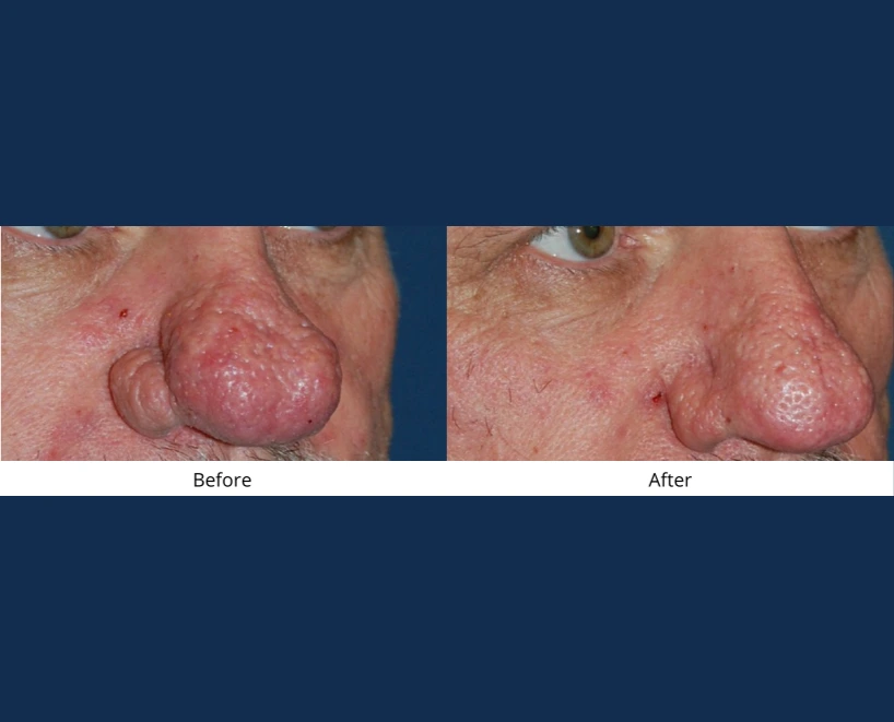 Only Faces Template - 2024-09-05T154948.635