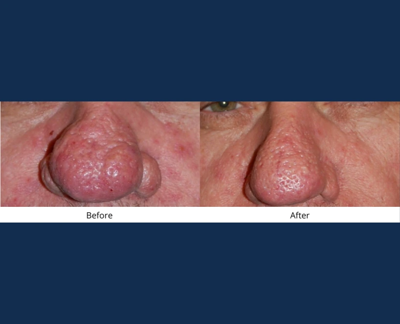 Only Faces Template - 2024-09-05T154955.025