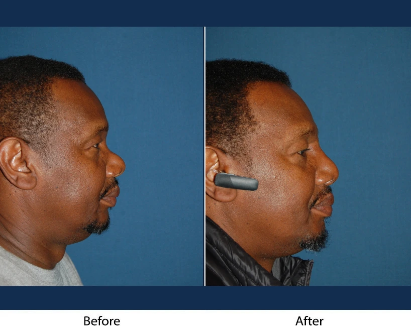 Only Faces Template - 2024-10-11T125631.775