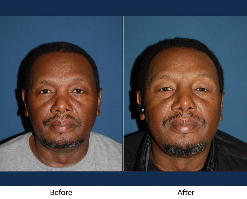 Only Faces Template - 2024-10-11T125706.499