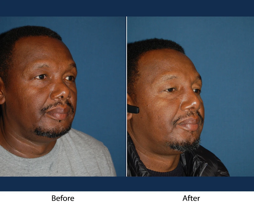 Only Faces Template - 2024-10-11T125719.789