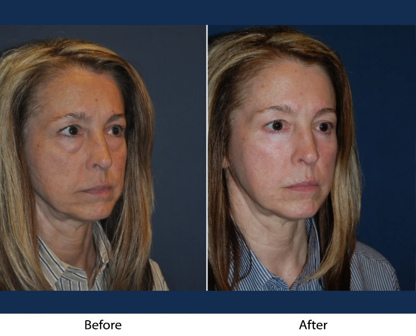 Only Faces Template (45)