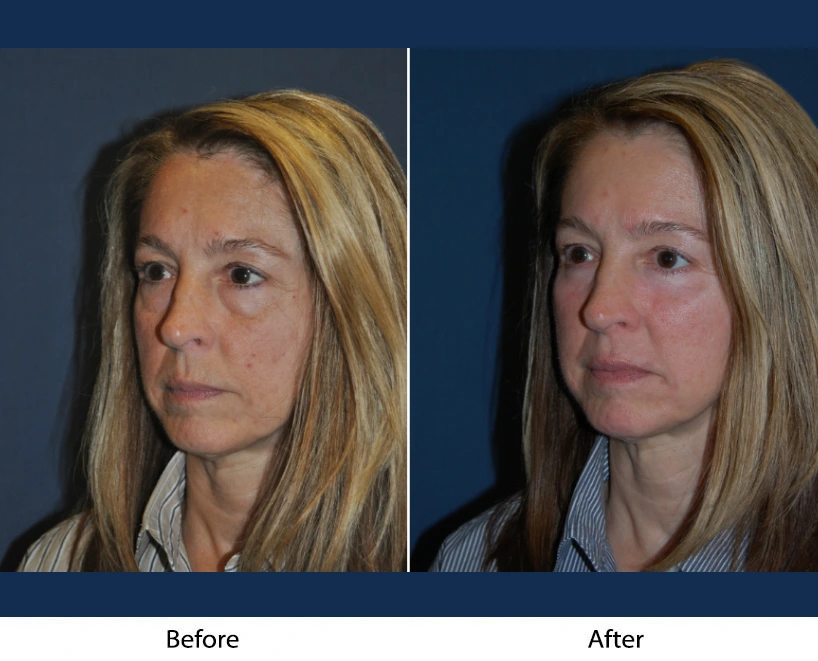 Only Faces Template (46)