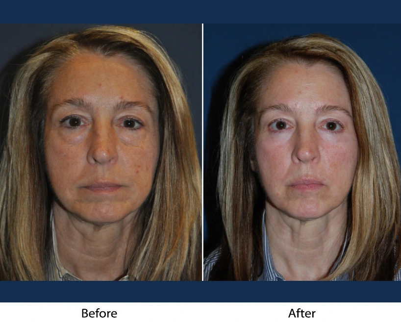 Only Faces Template (47)