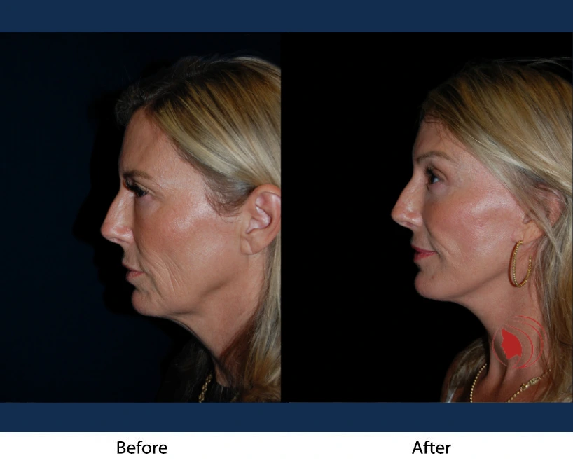 Only Faces Template (6)