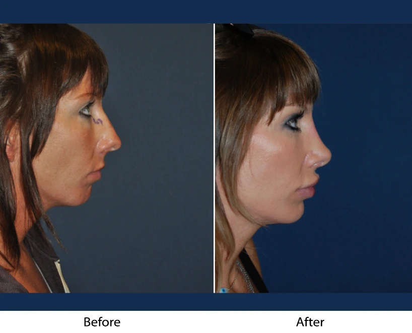 Only Faces Template (60)