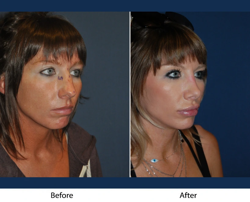 Only Faces Template (61)