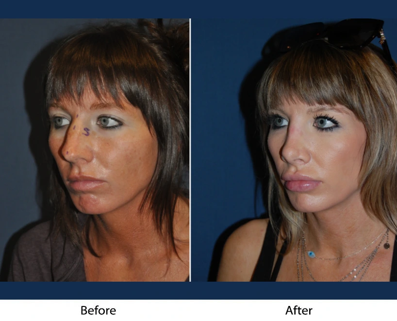 Only Faces Template (62)