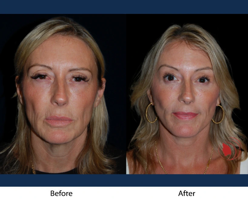 Only Faces Template (7)