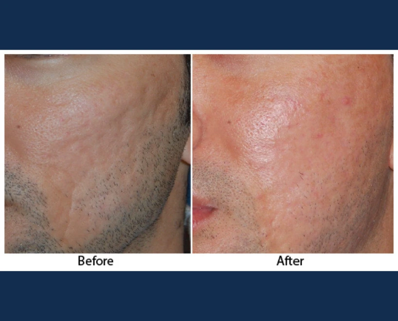 Only Faces Template (89)