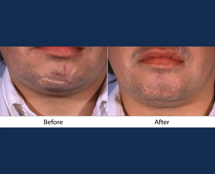 Only Faces Template (93)