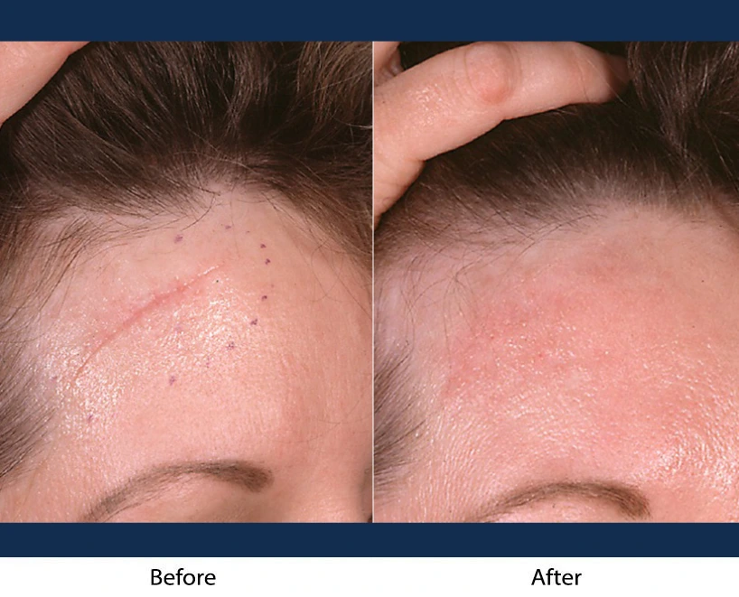 Only Faces Template (95)