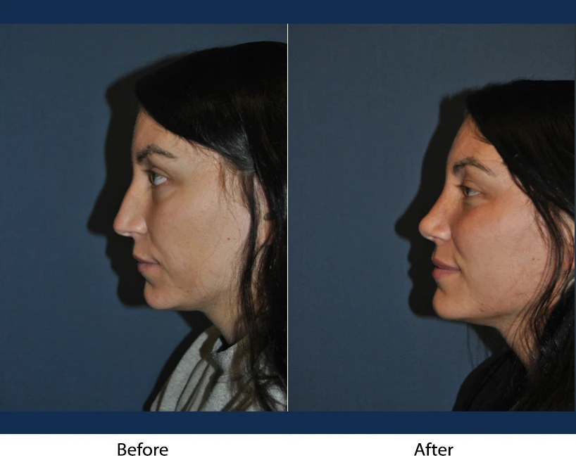 Only Faces Template - 2024-09-05T153347.376