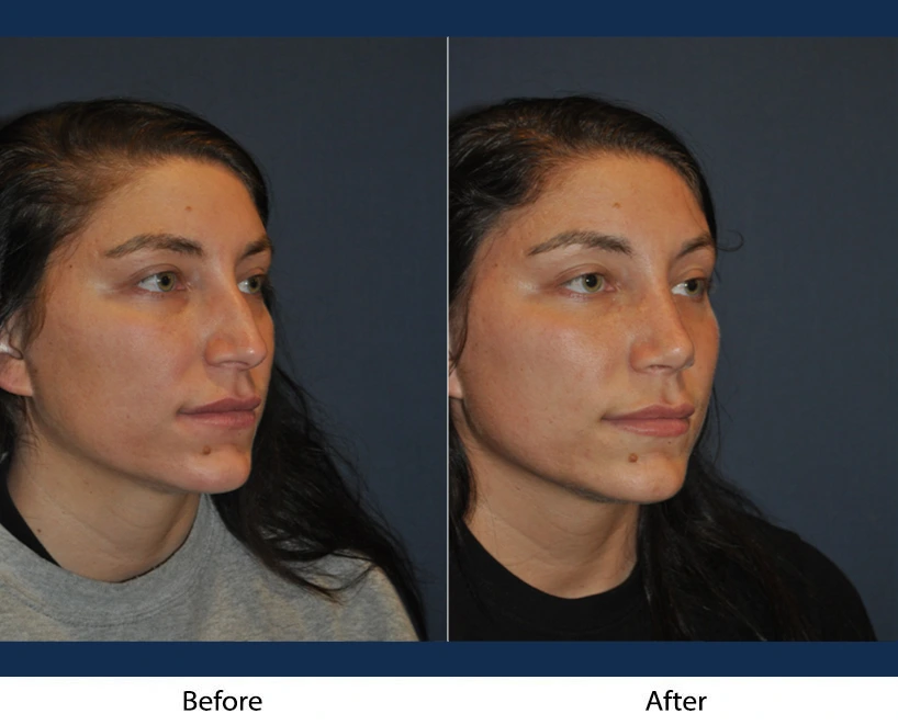 Only Faces Template - 2024-09-05T153408.365