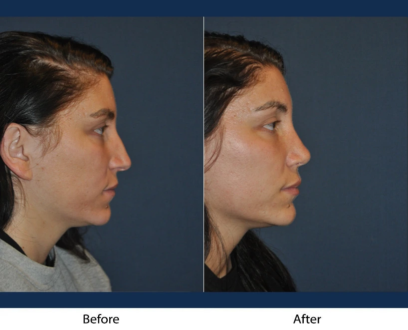 Only Faces Template - 2024-09-05T153431.042