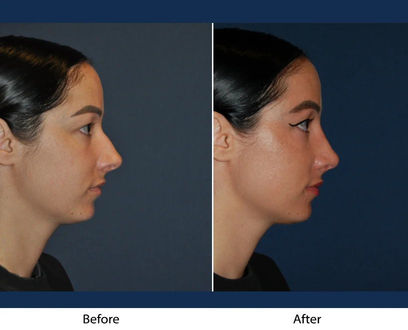 Only Faces Template - 2024-09-11T231846.194