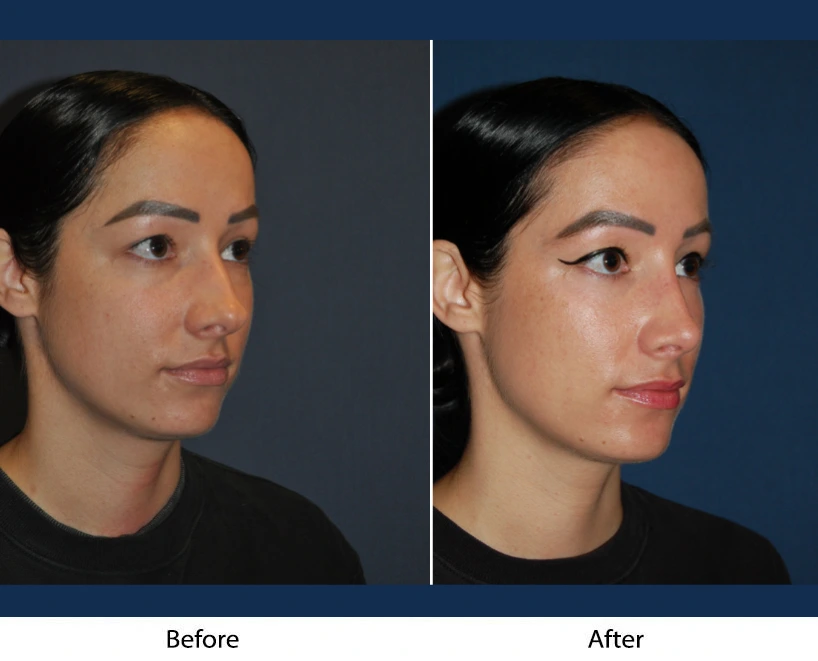 Only Faces Template - 2024-09-11T231911.614