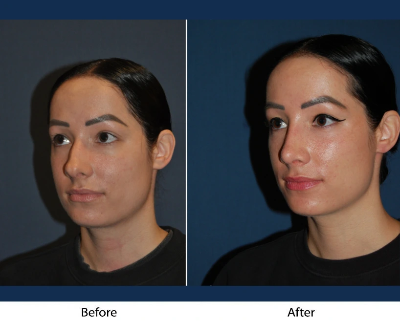 Only Faces Template - 2024-09-11T232028.207