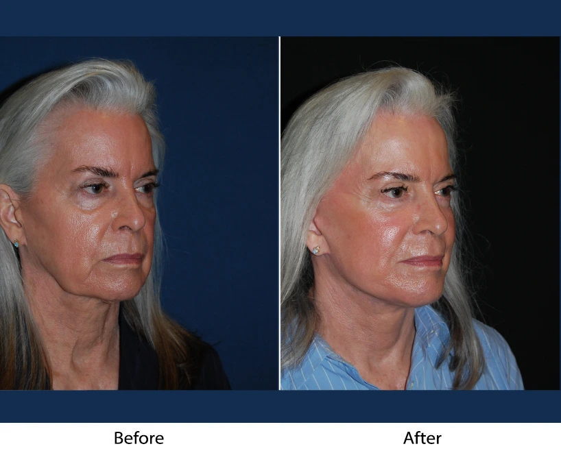 Only Faces Template - 2024-10-11T124139.398