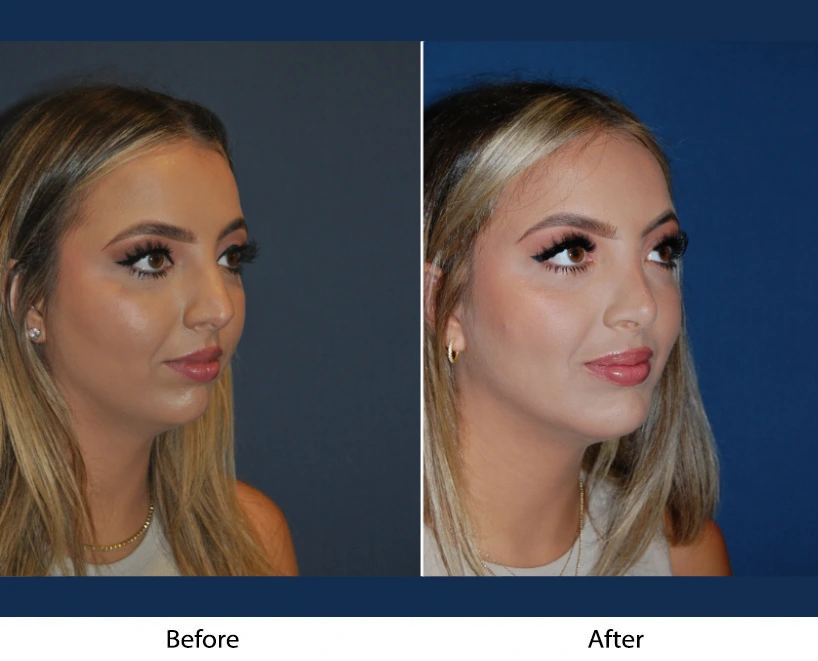 Only Faces Template (80)