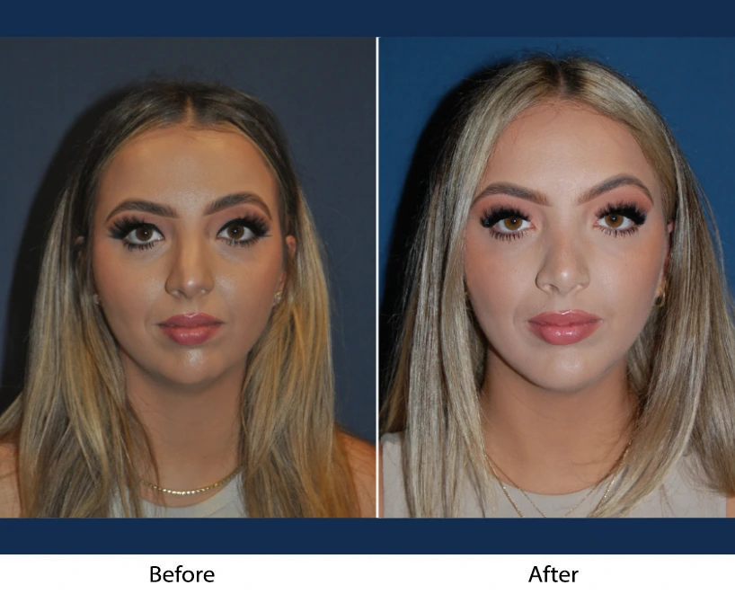 Only Faces Template (81)