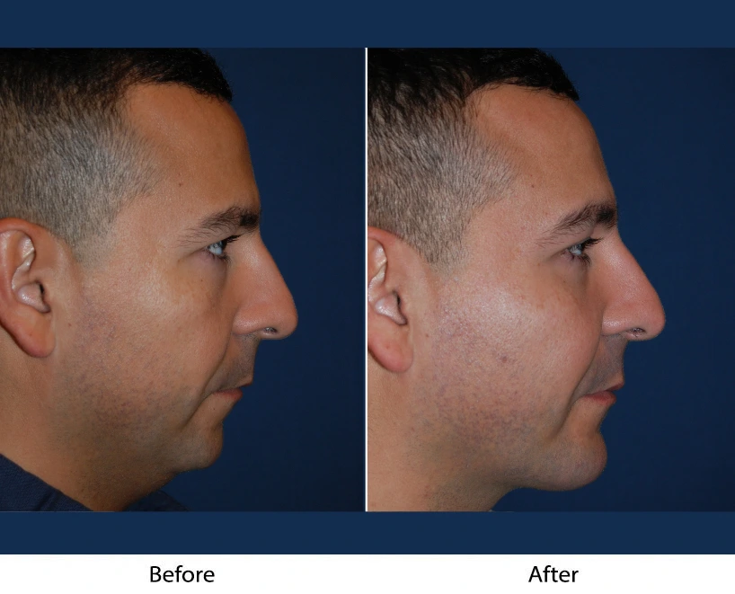 Only Faces Template - 2024-10-11T130726.640