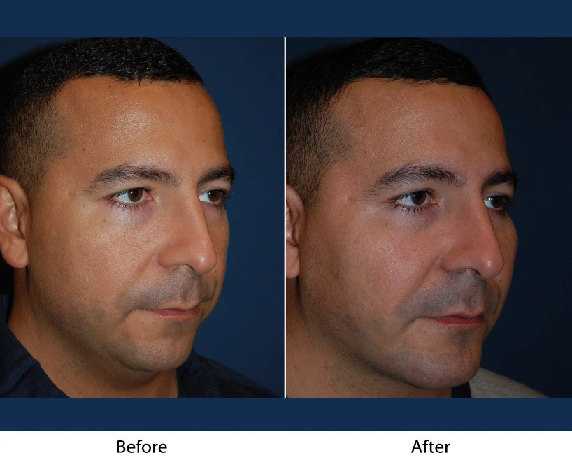 Only Faces Template - 2024-10-11T130830.529