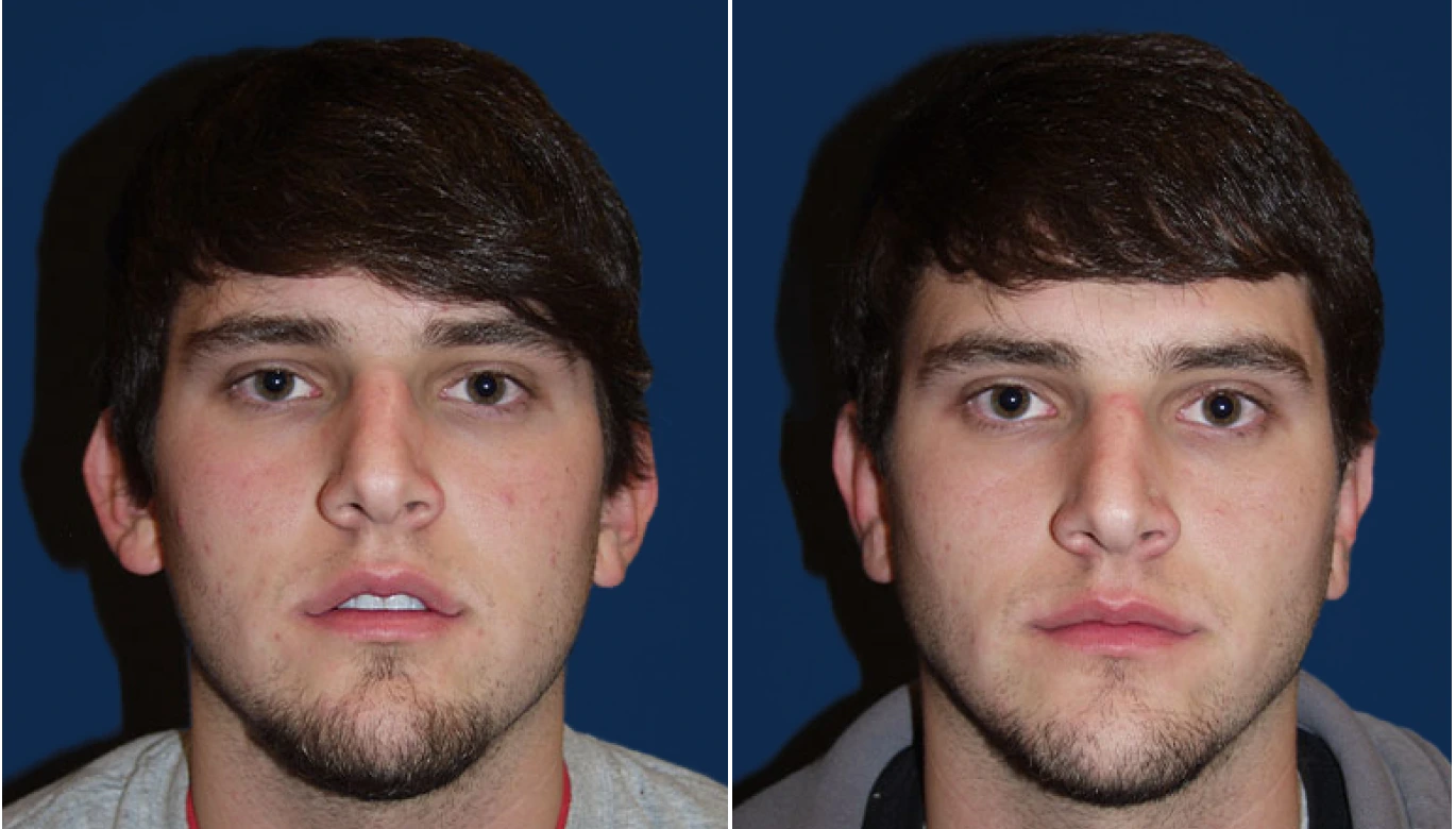 Before & After Banner