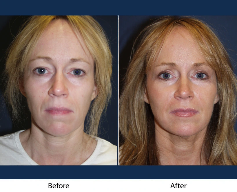 Only Faces Template - 2024-11-06T151119.302