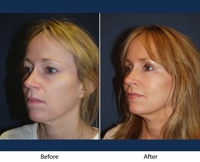 Only Faces Template - 2024-11-06T151200.934