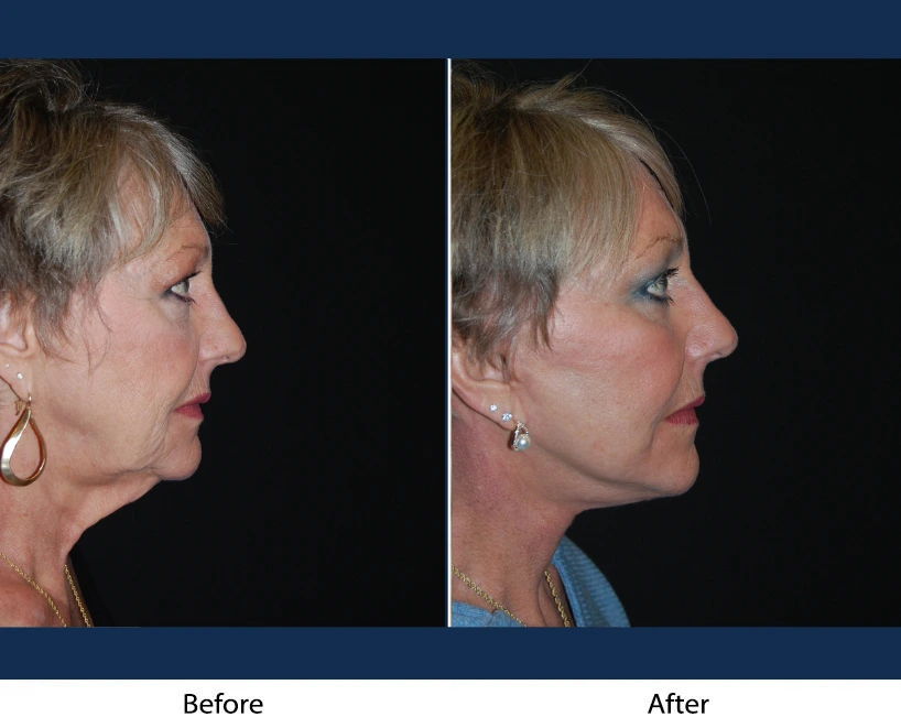 Only Faces Template - 2024-12-20T192807.602