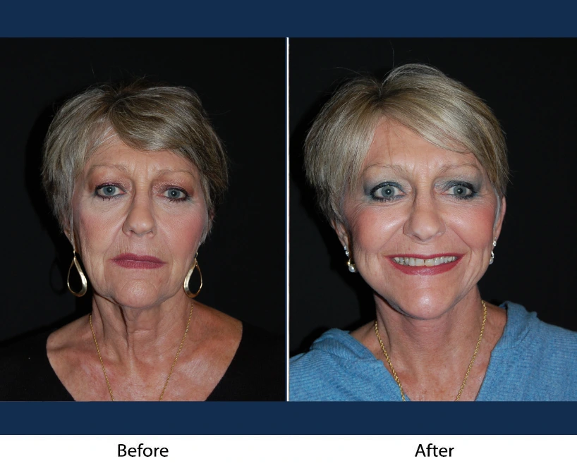 Only Faces Template - 2024-12-20T193107.507