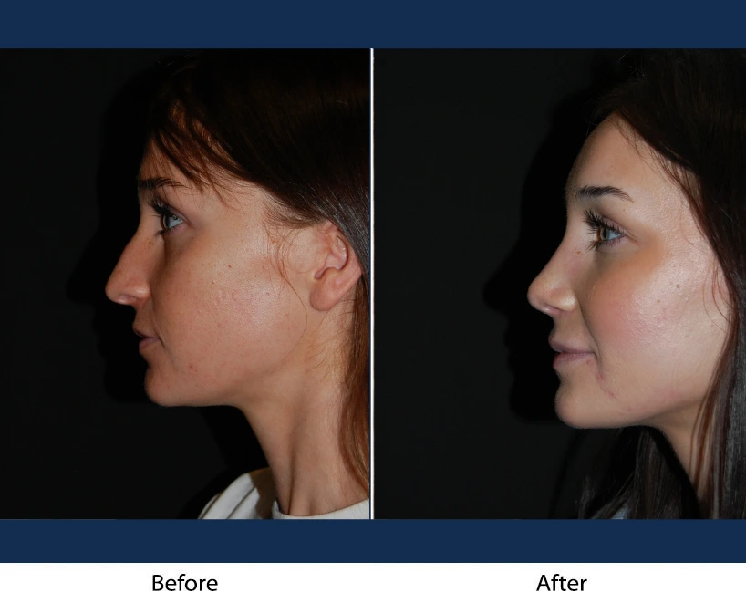 Only Faces Template - 2024-12-20T193320.554