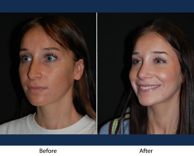 Only Faces Template - 2024-12-20T193345.181